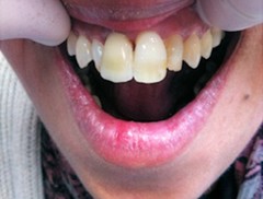 dental ceramics manchester